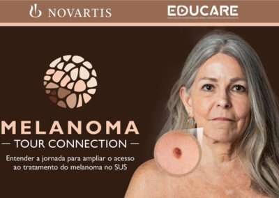 Melanoma – Tour Connection
