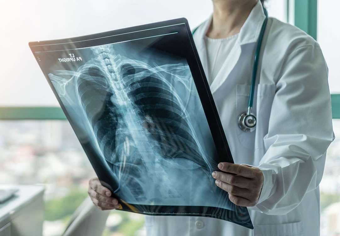 Você precisa conhecer o estudo ADAURA! Especialistas explicam o porquê.