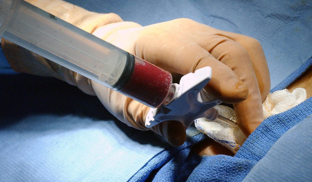 Semana de Mobilização Nacional para Doação de Medula Óssea promoverá engajamento e conscientização no Tecnopuc